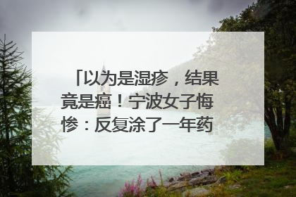 以为是湿疹，结果竟是癌！宁波女子悔惨：反复涂了一年药膏都没好！很多患者首诊都去了皮肤科